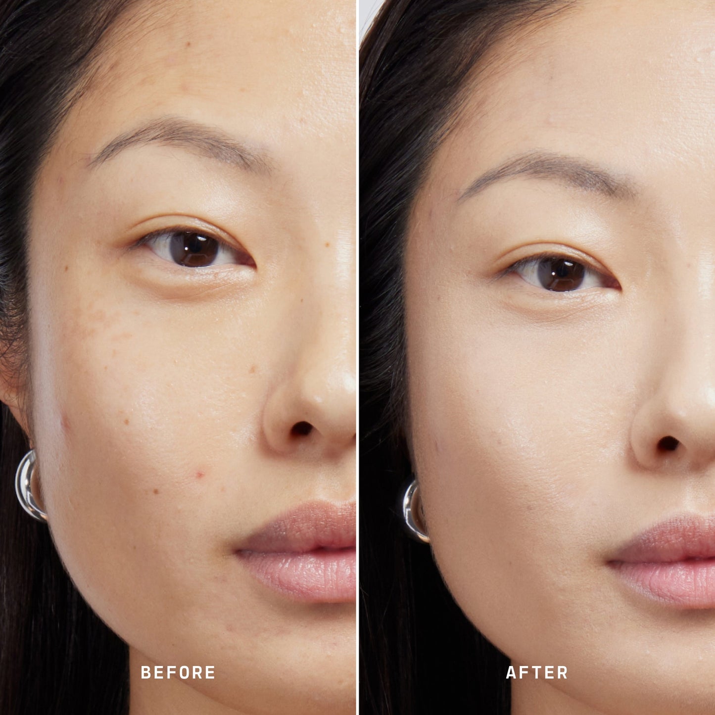 Skin Solution