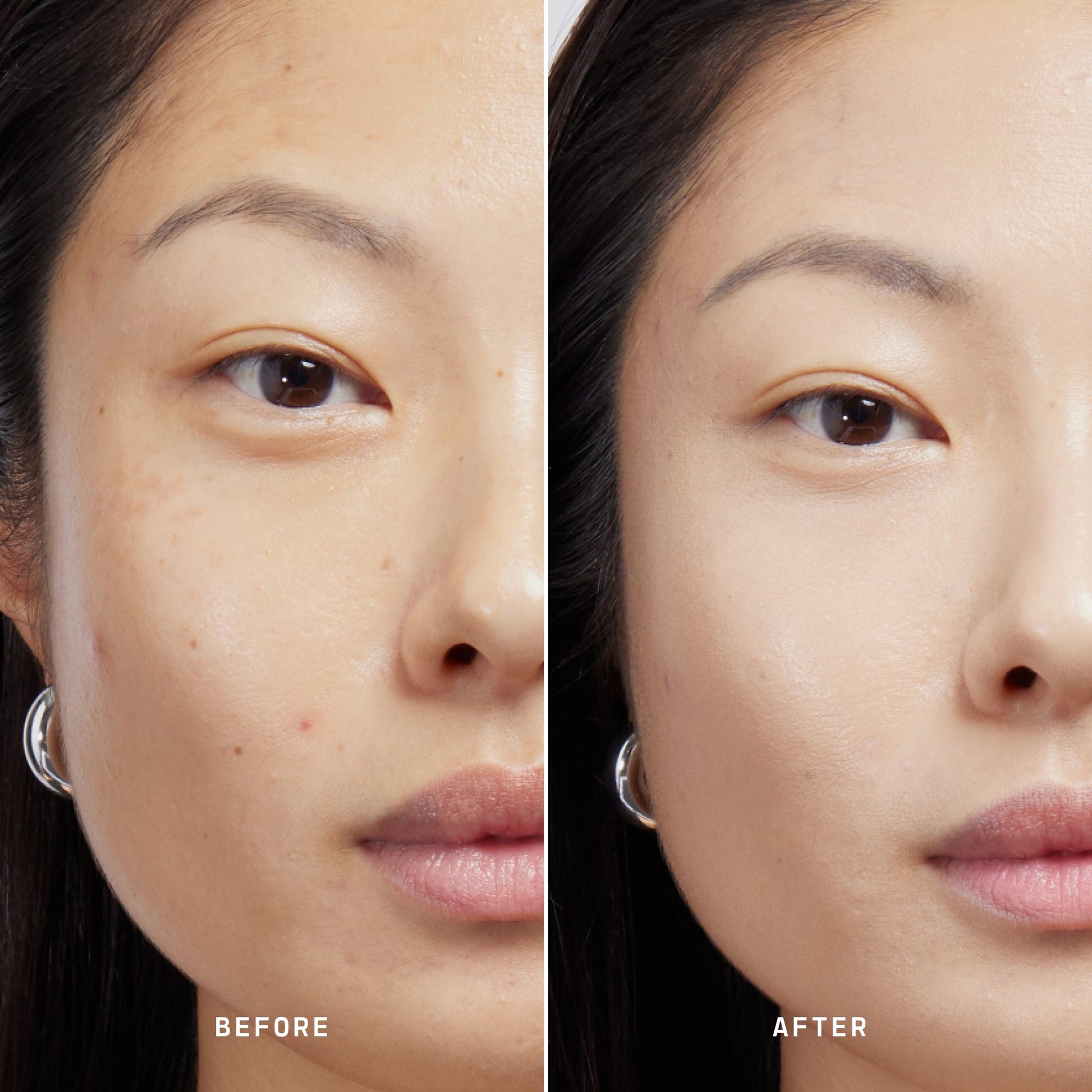 Skin Solution