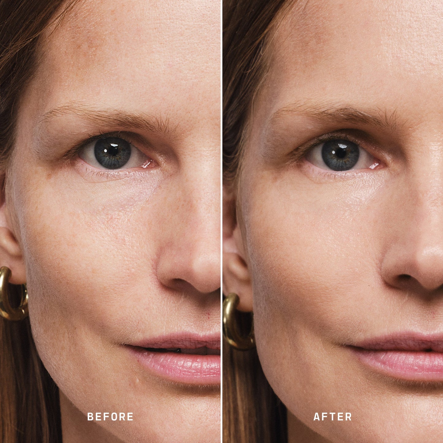 Skin Solution