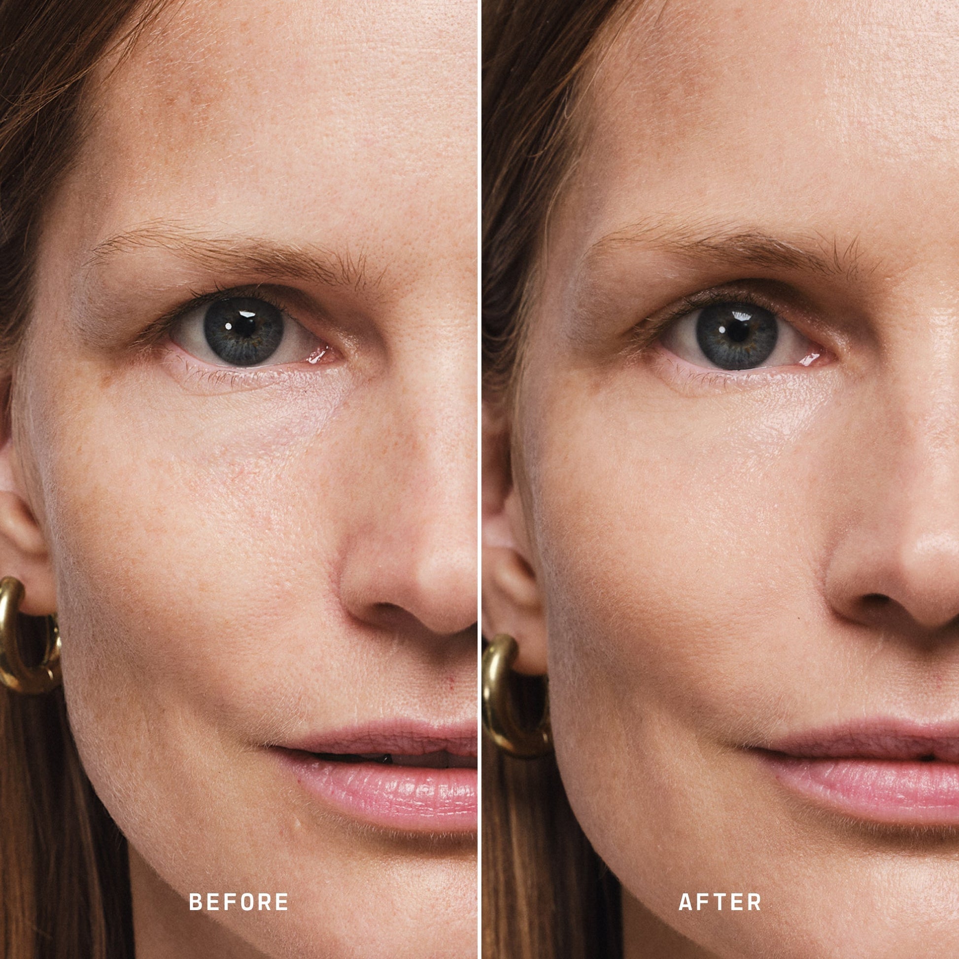 Skin Solution