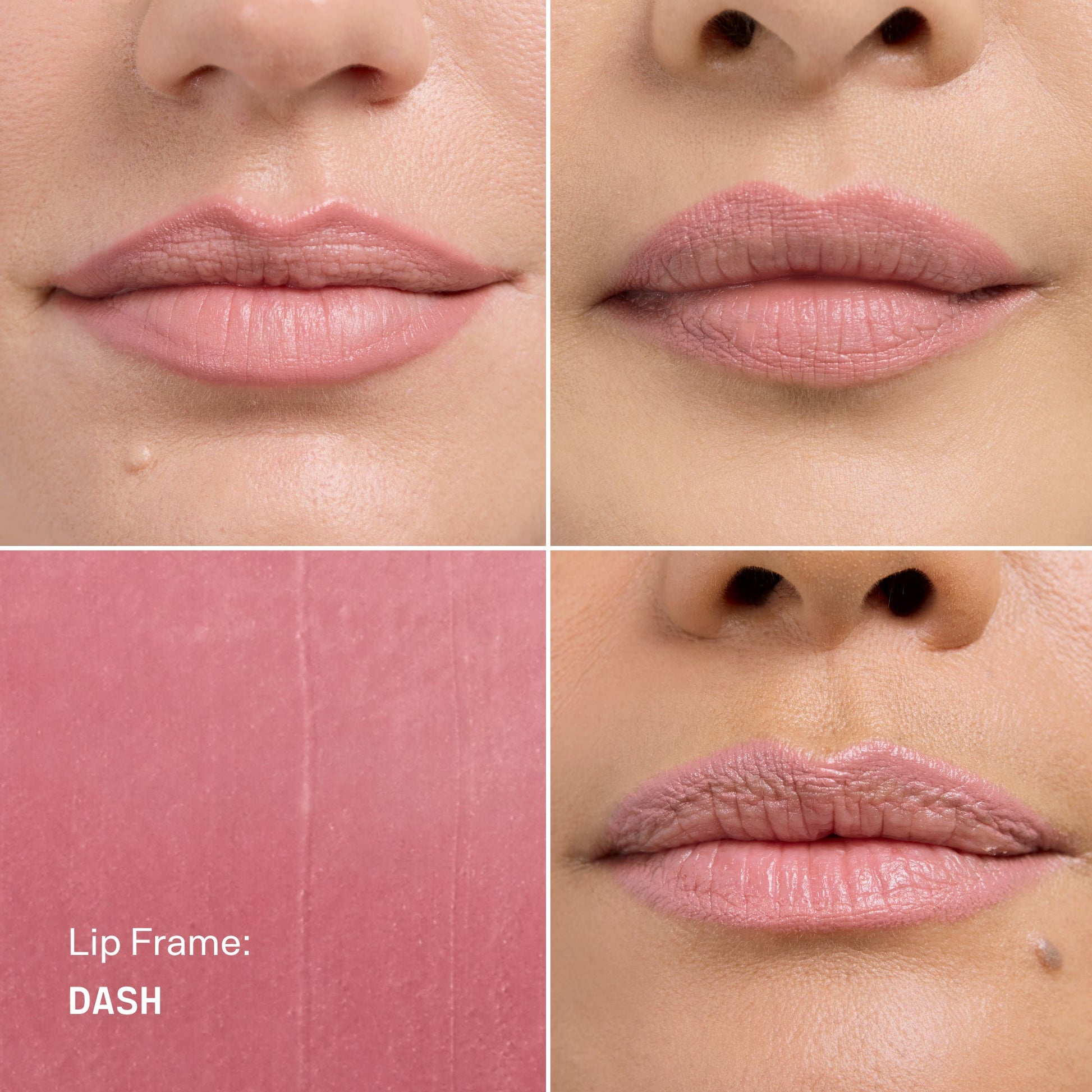 Lip Frame