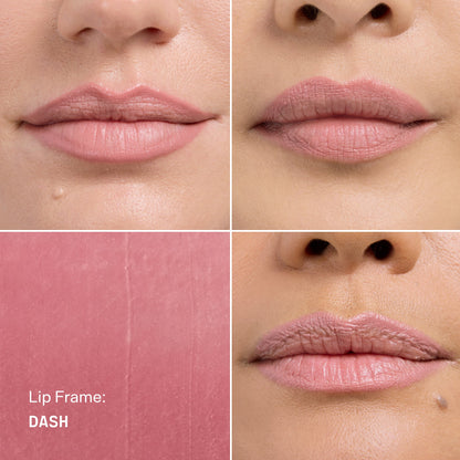 Lip Frame