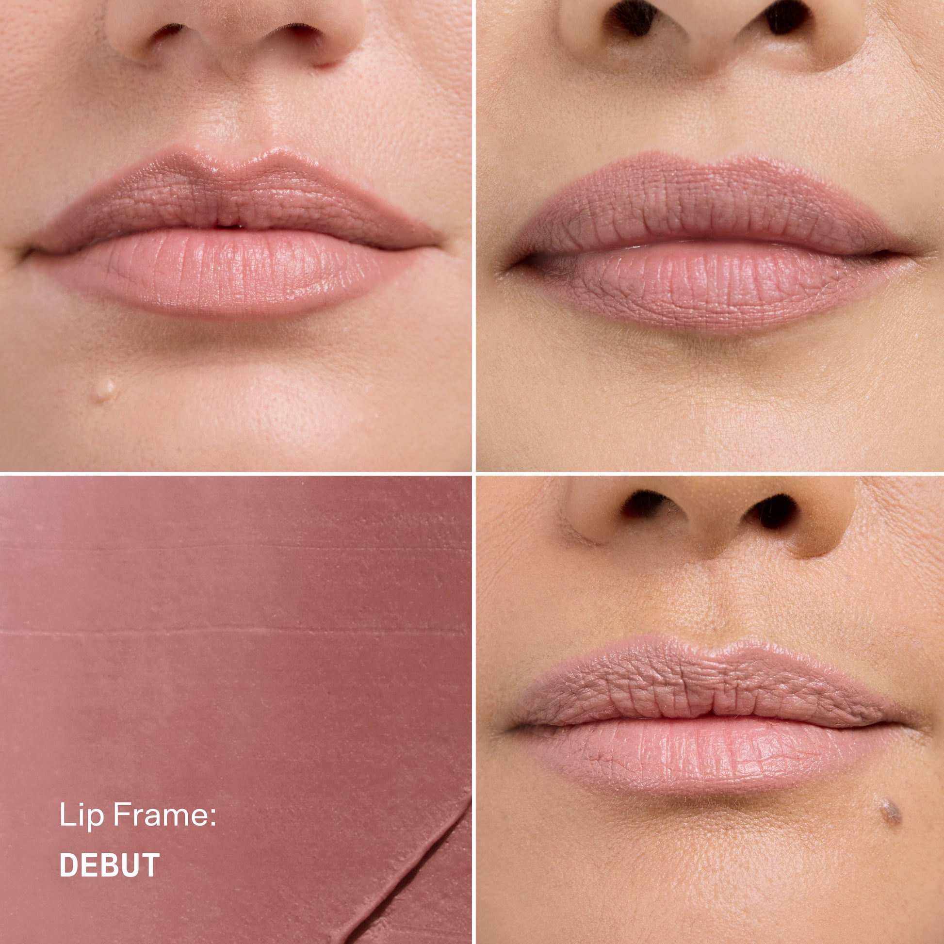 Lip Frame