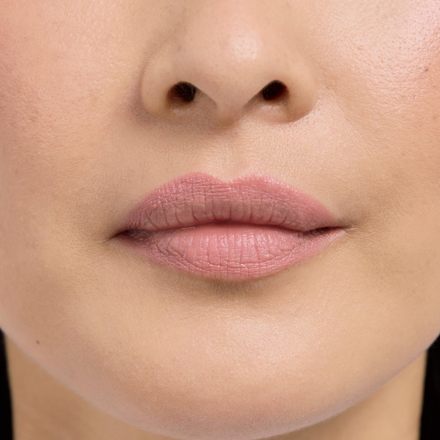 Lip Frame