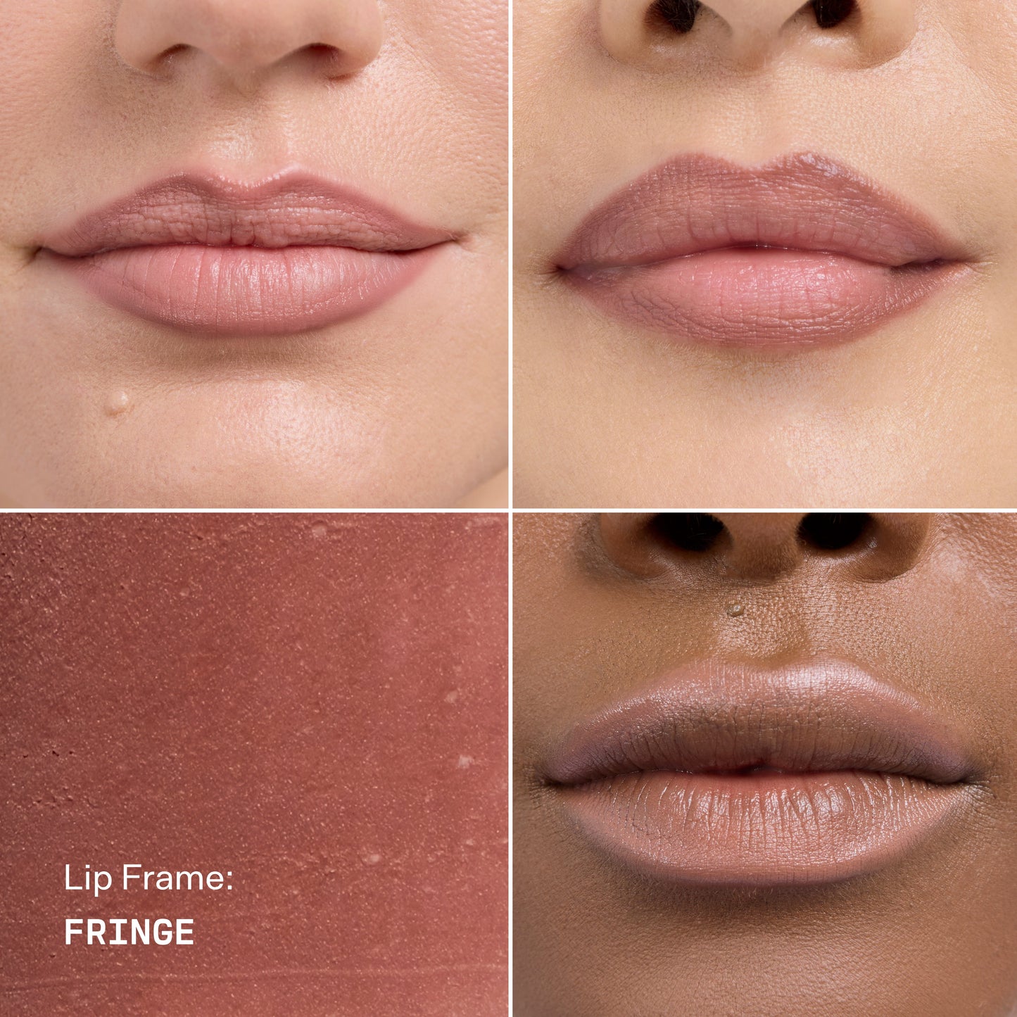 Lip Frame