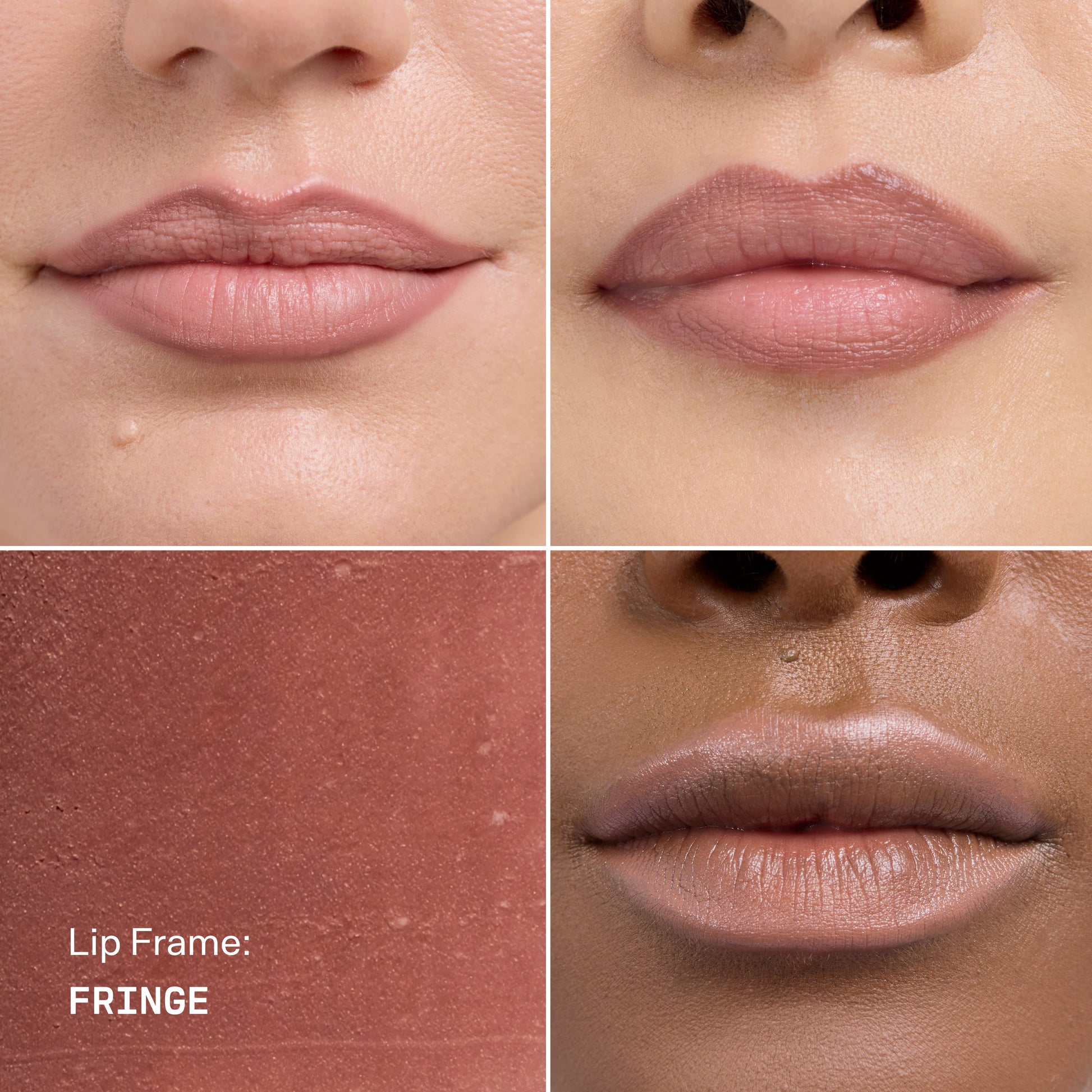 Lip Frame