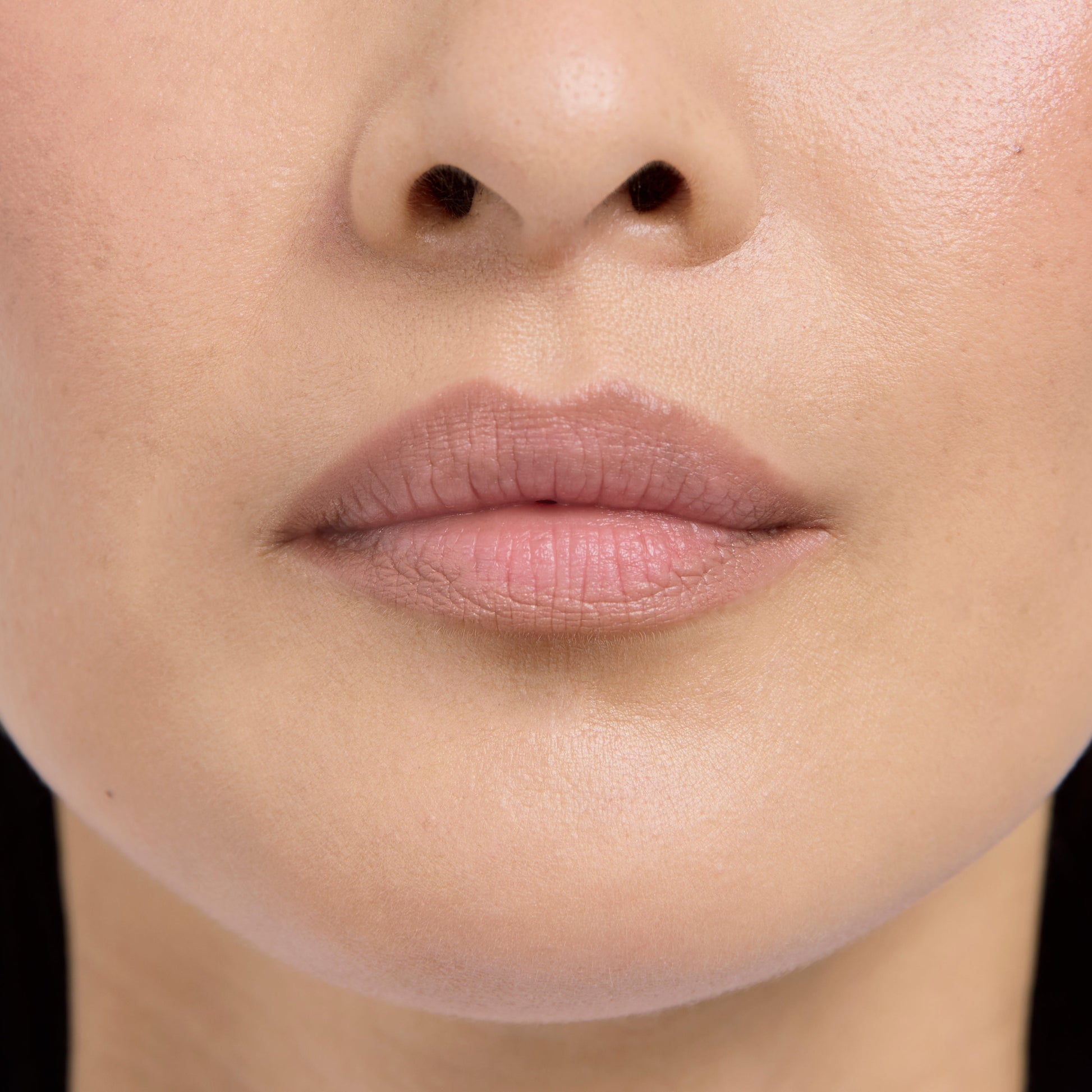 Lip Frame