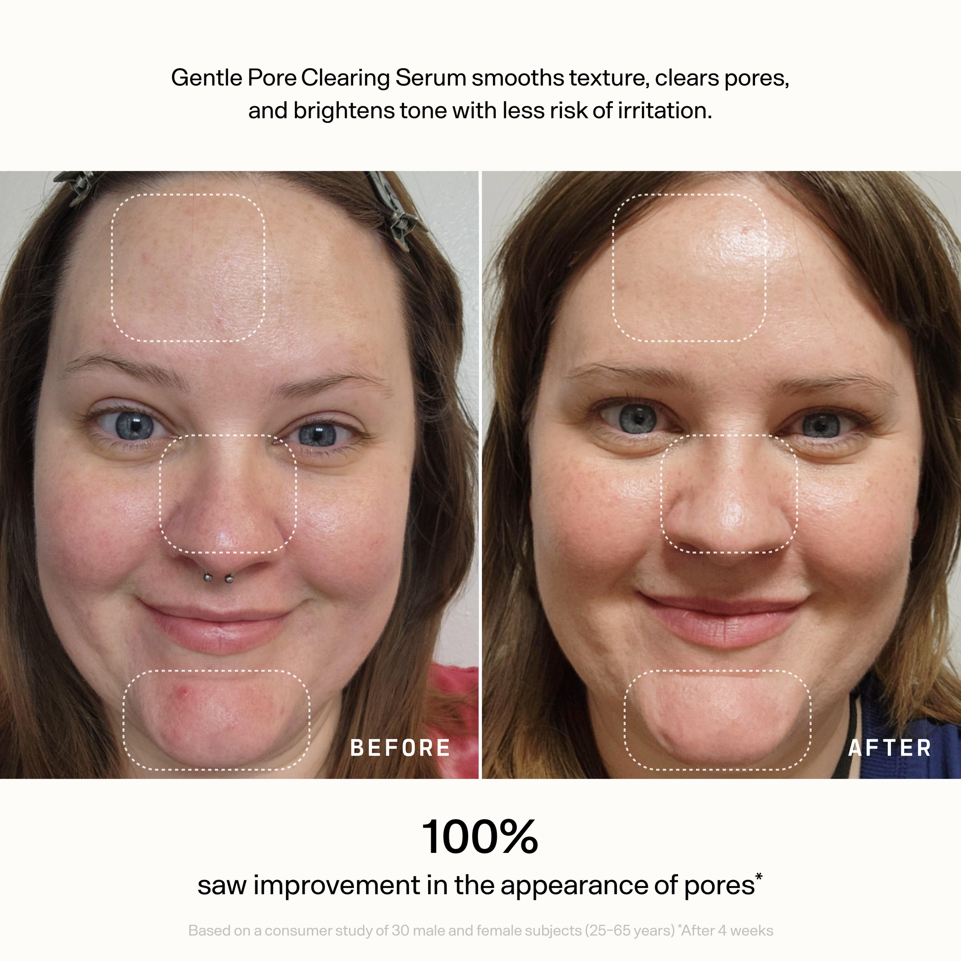 Skin Refine