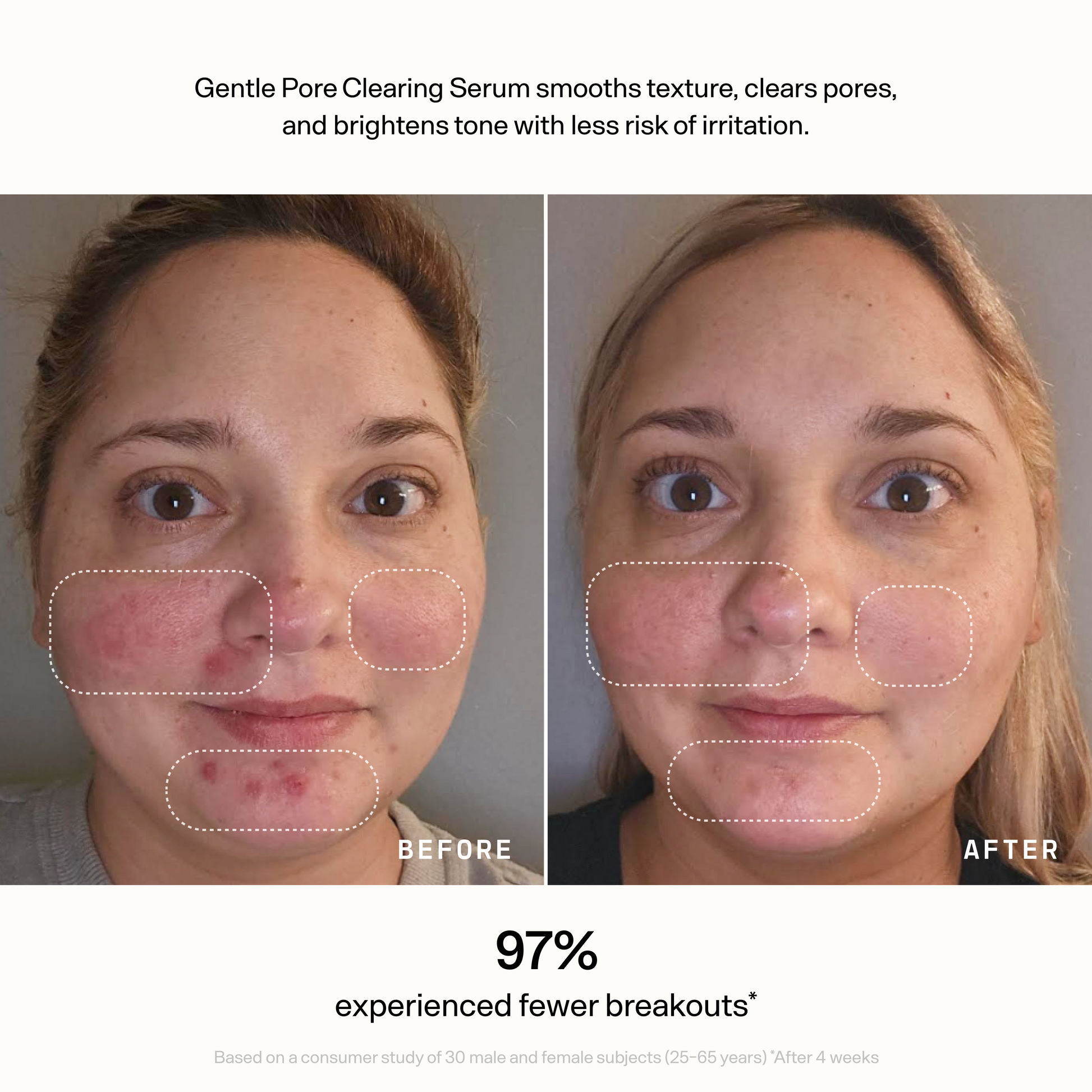Skin Refine