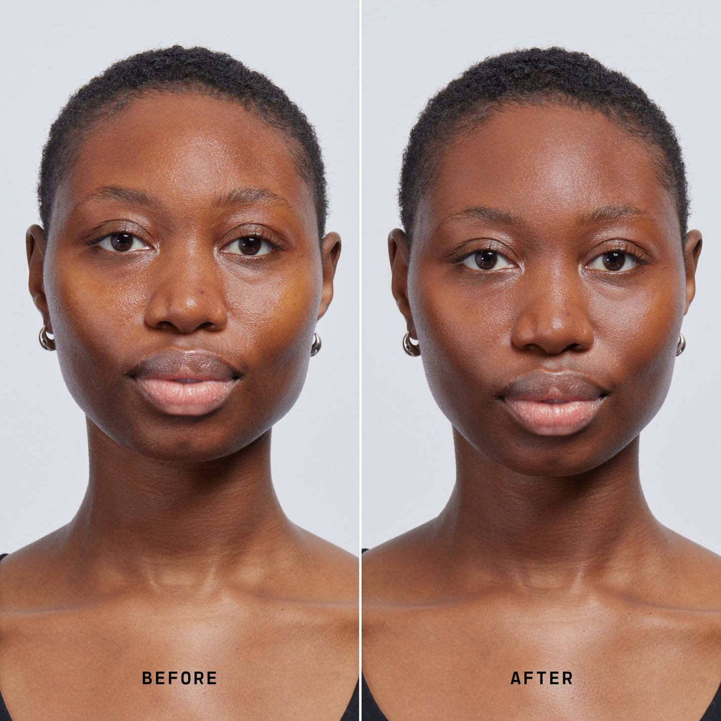 Skin Solution