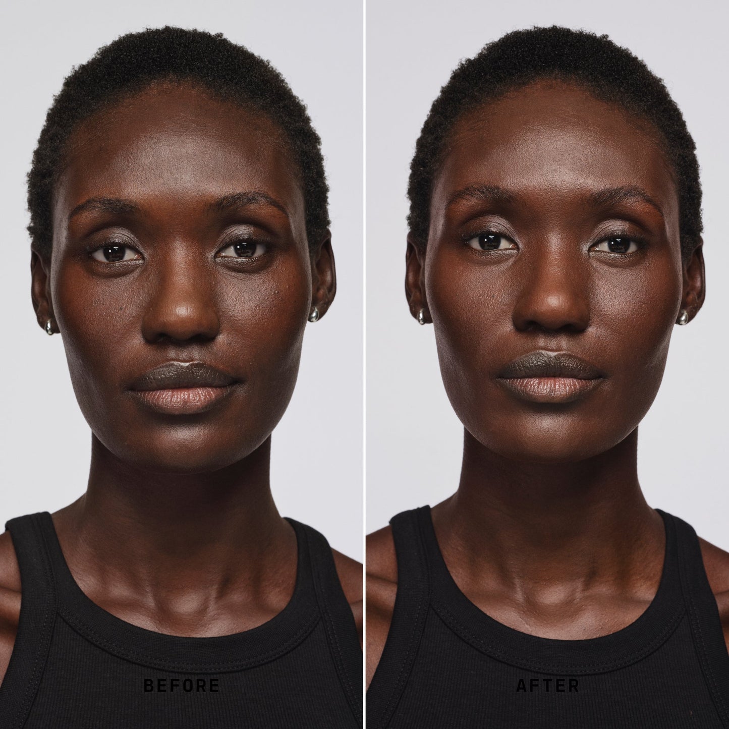 Skin Solution