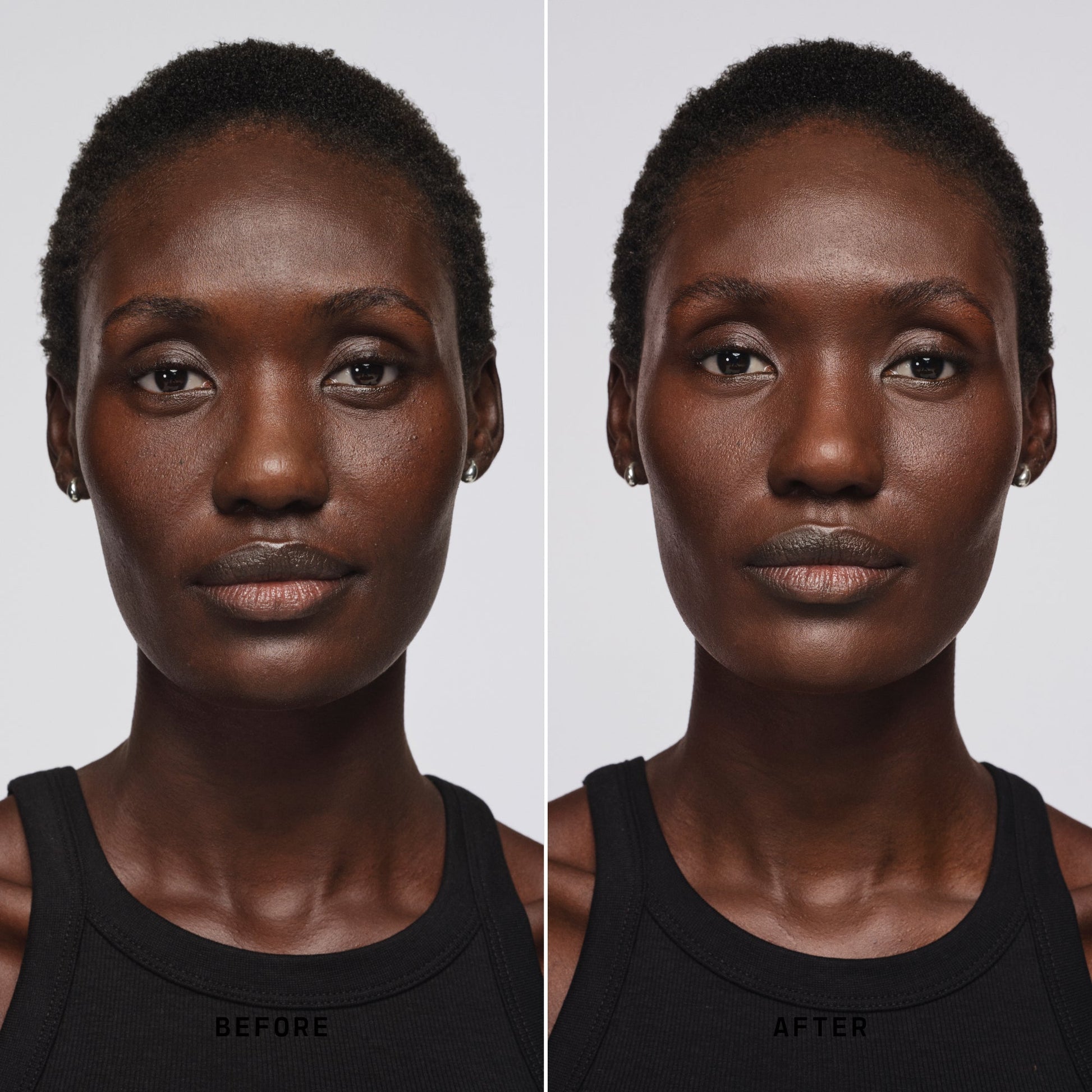 Skin Solution