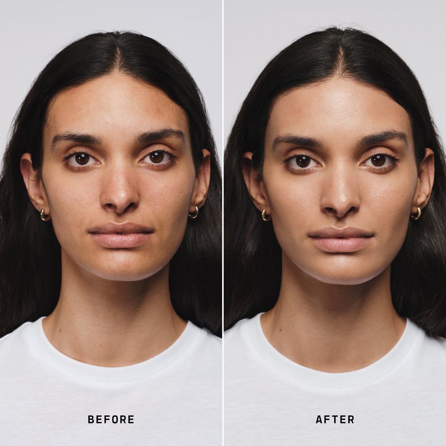 Skin Solution